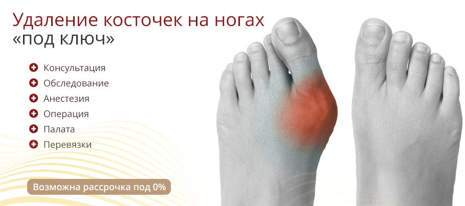 Акция! Комплексы оперативного лечения «косточек на ногах» в Москве