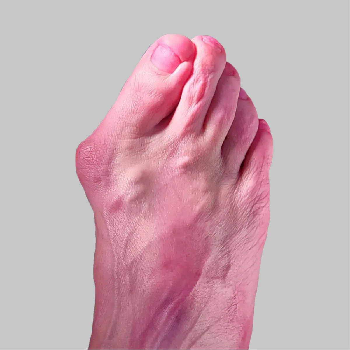 До