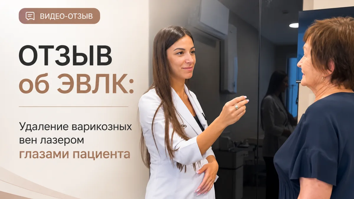 Отзыв об ЭВЛК: Удаление варикозных вен лазером глазами пациента