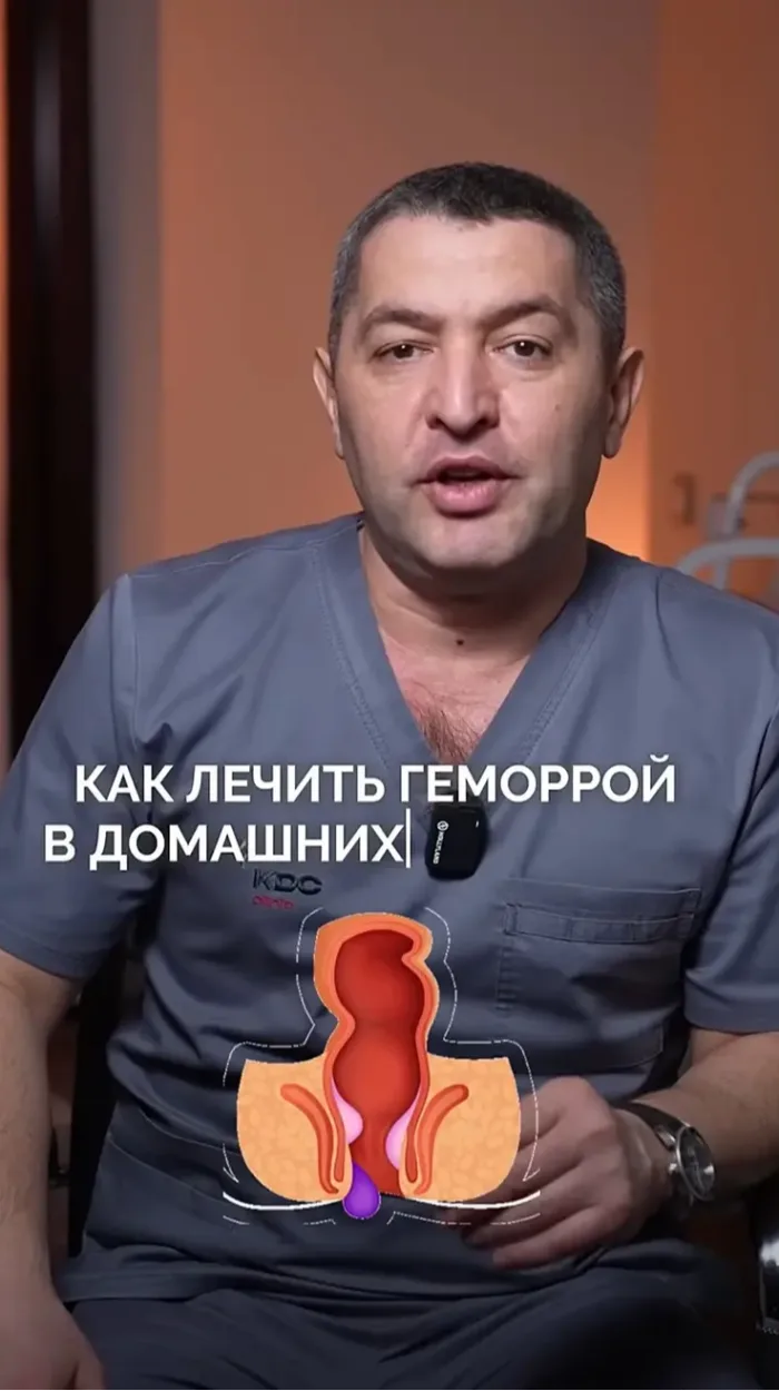 Как лечить геморрой в домашних условиях? 🤫