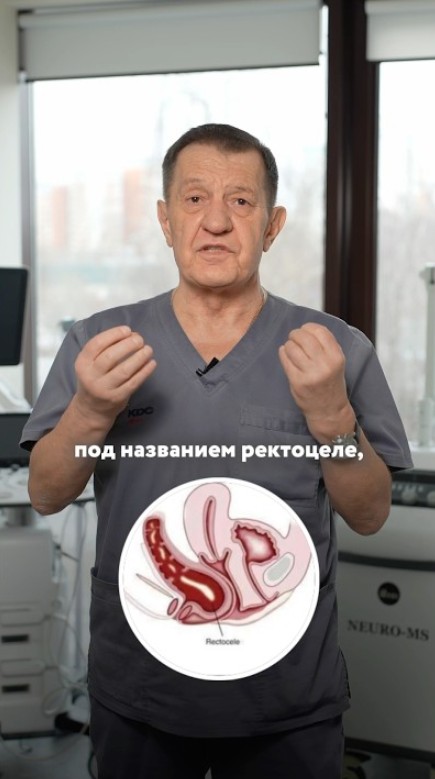 Главная причина запора у женщин. Объясняет врач проктолог