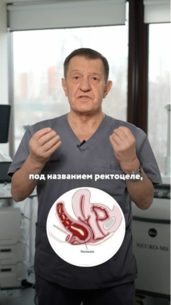 Главная причина запора у женщин. Объясняет врач проктолог
