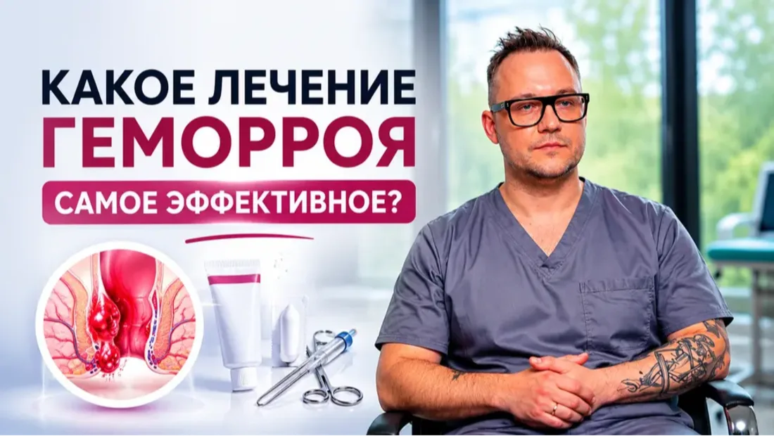 Какое лечение геморроя является самым эффективным? 🤔
