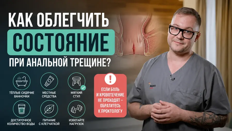 Как облегчить состояние при анальной трещине?