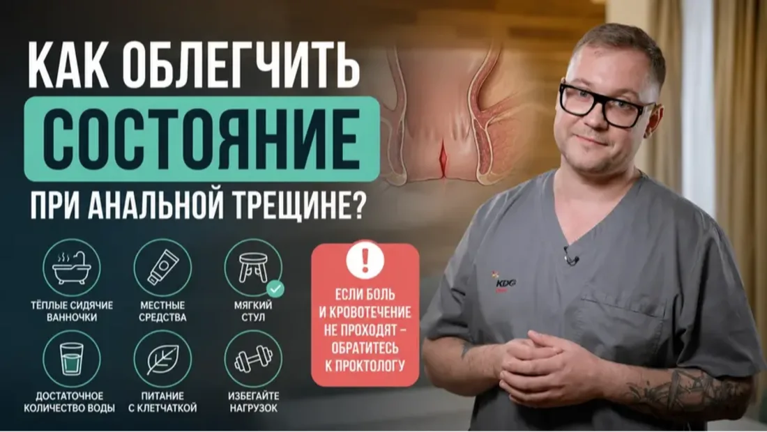 Как облегчить состояние при анальной трещине?