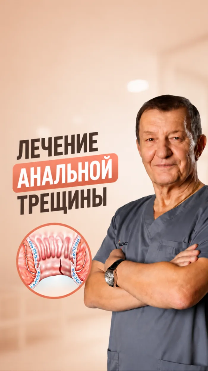 Современное лечение анальной трещины. Методики снятия спазма анального сфинктера.