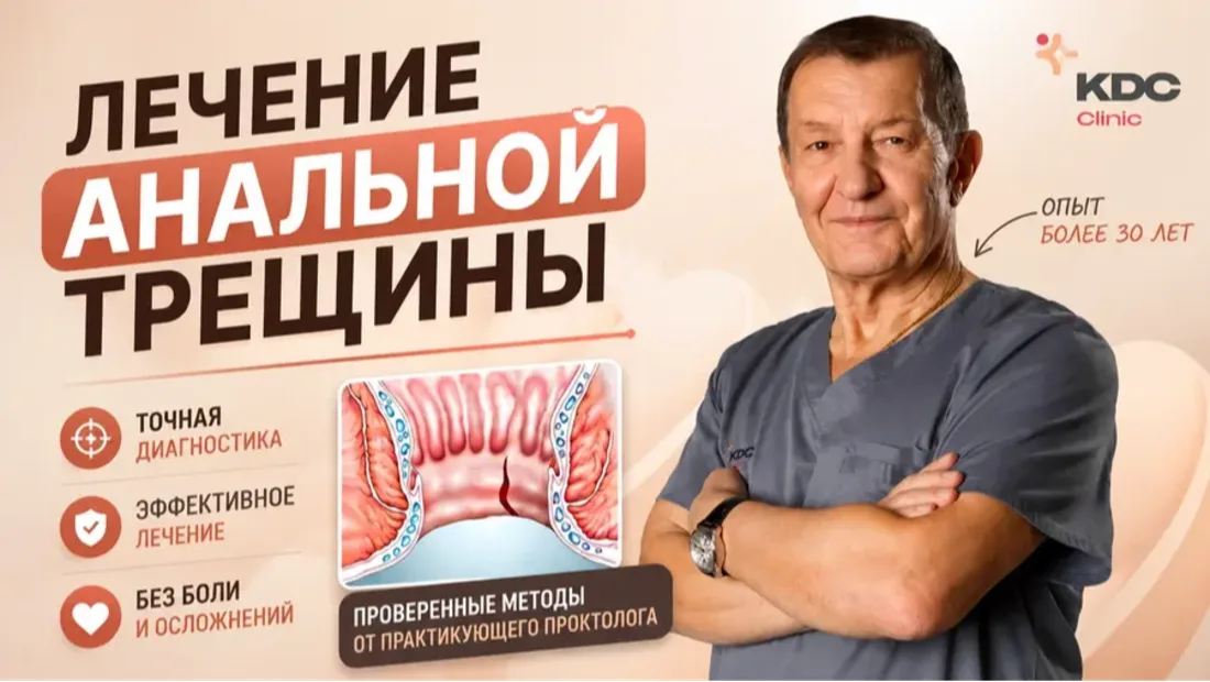 Современное лечение анальной трещины. Методики снятия спазма анального сфинктера.