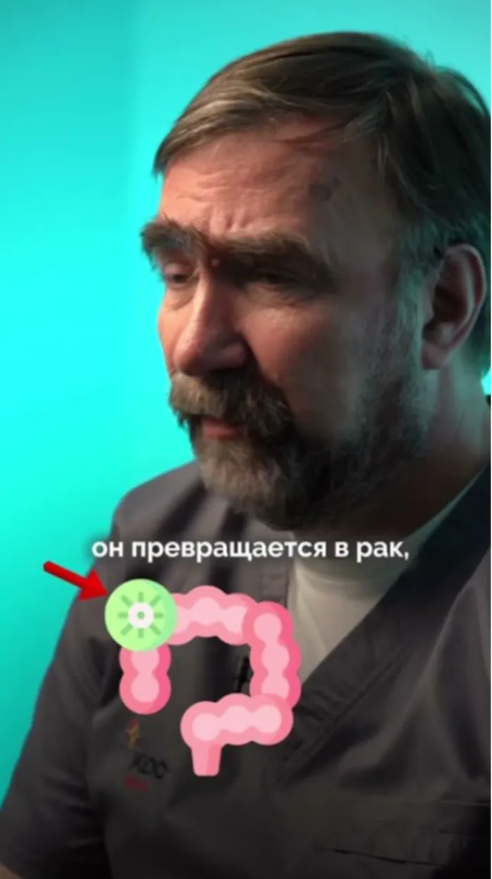 Как не заболеть раком толстой кишки?