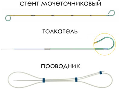 Стент для мочеточника