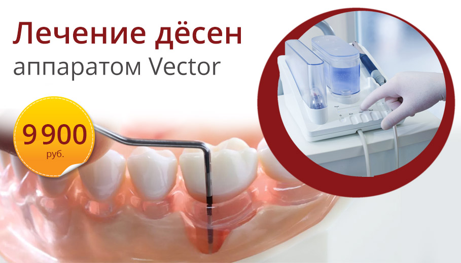 Акция «Лечение заболеваний дёсен» аппаратом Вектор - 9900 рублей за 2 челюсти полностью