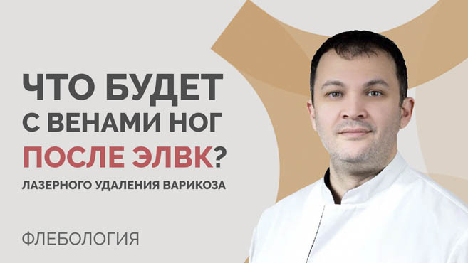 Что будет с веной после операции лазерного удаления варикоза (ЭВЛK)?